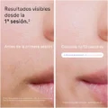 Depiladora Laser Braun Skin i·expert PL7253
